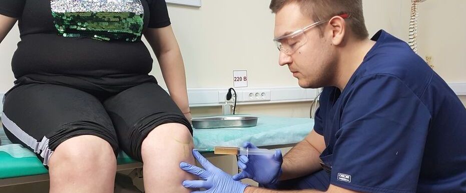 Un médico ortopédico realiza una inyección intraarticular en la articulación de la rodilla para la osteoartritis