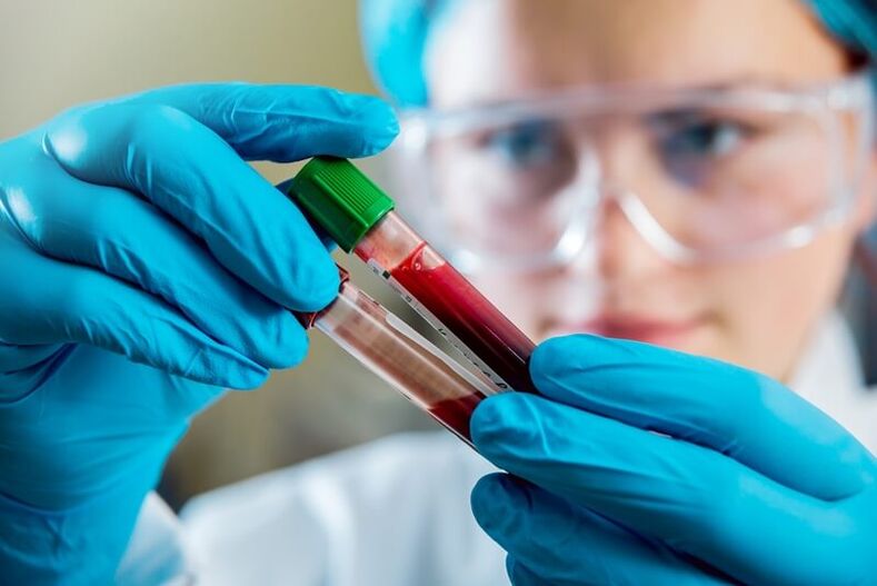 Análisis de sangre completo para diagnosticar el dolor lumbar.